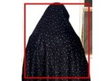 اسیدپاشی وحشتناک دختر بدجنس به روی پدر+ عکس