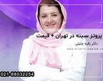 عوامل مهم در تعیین قیمت پروتز سینه در تهران
