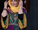 تغییر چهره عجیب بهنوش بختیاری 