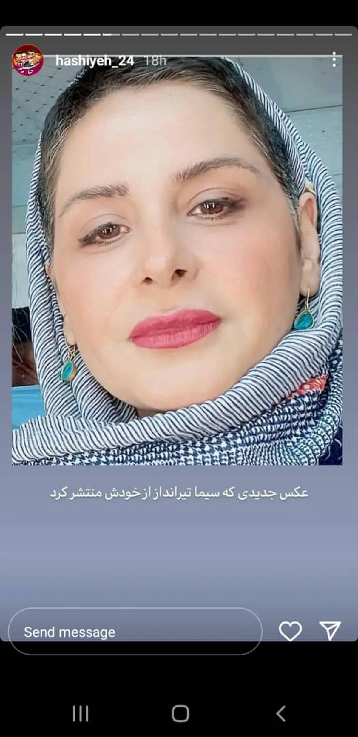 بوتاکس خیلی تابلوی سیما تیرانداز تو ذوق زد! | سیما تیرانداز هم قاطی خانومای تزریقی شد!