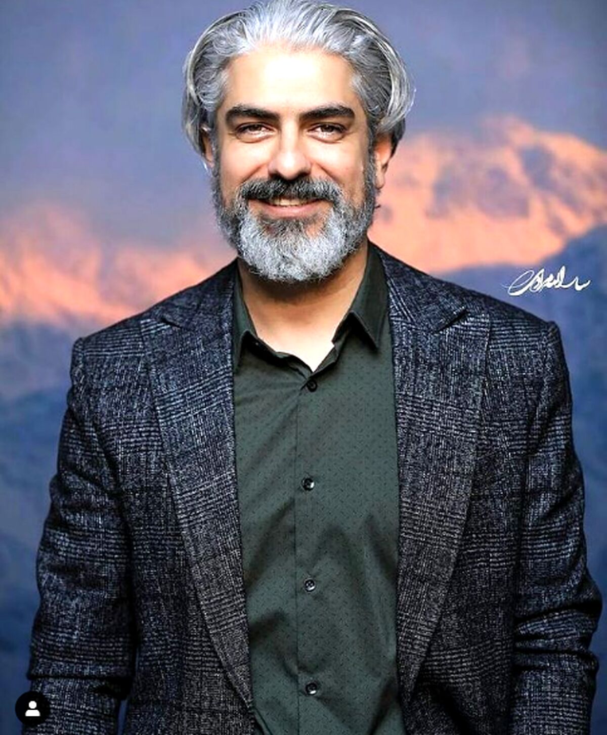 تغییر چهره مهدی پاکدل همه را شوکه کرد!