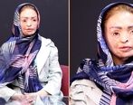 چهره هولناک دختر تبریزی همه را ترساند