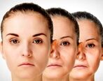 این مکمل غذایی از پیر شدن جلوگیری می کند