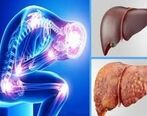 چرا مبتلایان به کبد چرب جان خود را از دست می دهند؟