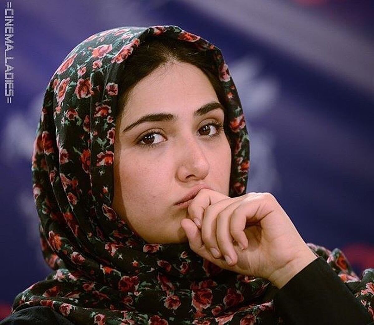 کبره وحشتناک صورت باران کوثری | باران کوثری مریض شد!+ عکس شوکه کننده
