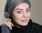 ورم عجیب صورت سحر قریشی بعد از تزریق زیبایی| صورت سحر قریشی نابود شد+ عکس