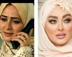 الهام حمیدی صورت خود را نابود کرد | الهام حمیدی با مژه هایش از دست رفت! 