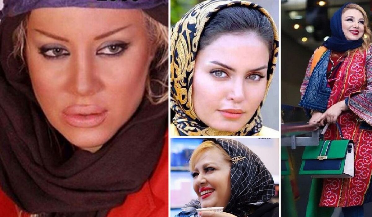 زیبایی پلاستیکی  این چند بازیگر زن ایرانی را ببینید! | جراحی پلاستیکو تا آخر راه رفتن!