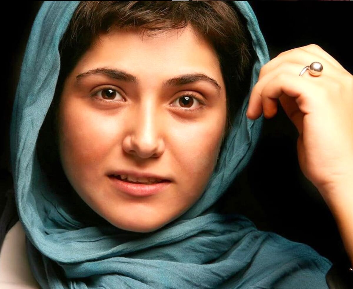 تغییر چهره وحشتناک باران کوثری/ عکس دیده نشده