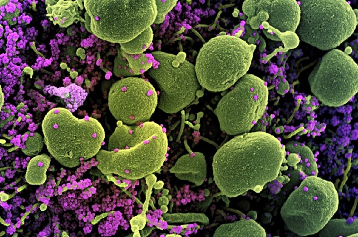 آیا واقعا ویروس کرونای آفریقایی آنتی‌بادی کمتری تولید می‌کند؟