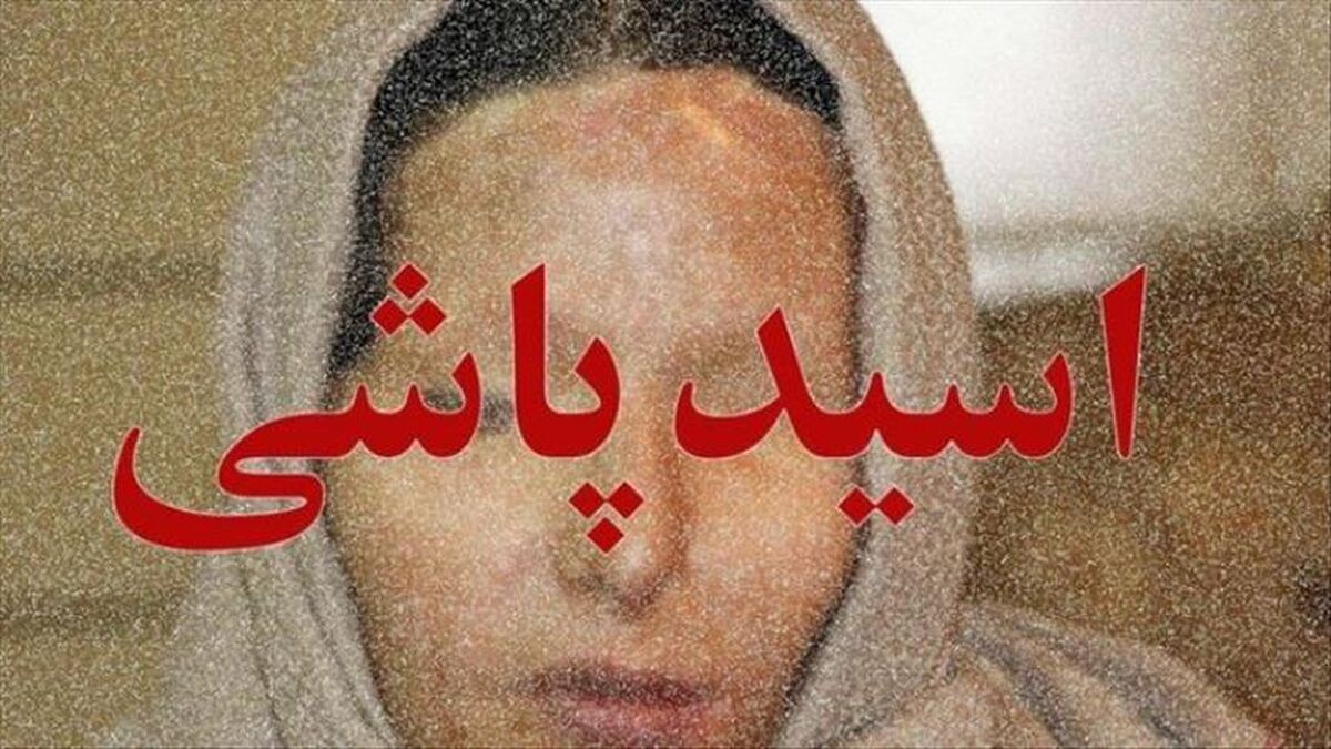 اسید پاشی به پدر و کودک خردسال قلب همه را به درد آورد