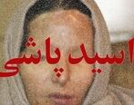 اسید پاشی به پدر و کودک خردسال قلب همه را به درد آورد