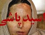 اسید پاشی به پدر و کودک خردسال قلب همه را به درد آورد