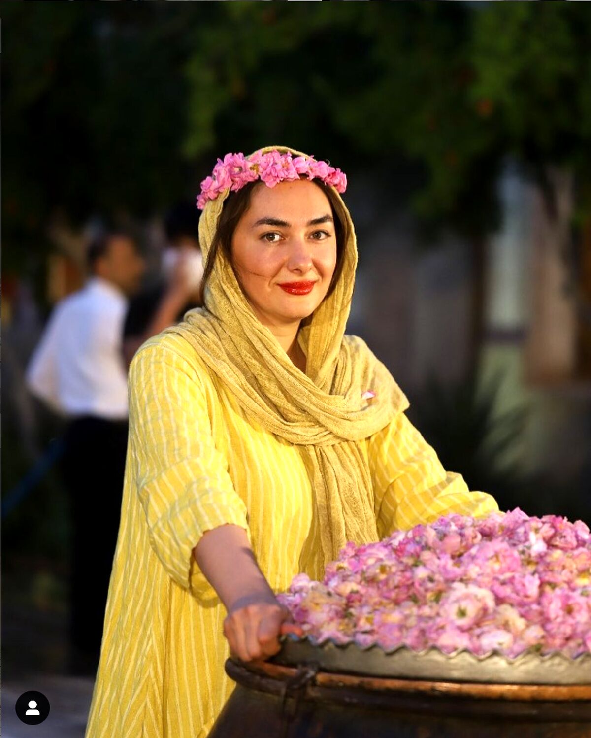 پوست وارفته و پیر هانیه توسلی + عکسی که باور نمی کنید