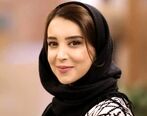 کج شدن فک بازیگر مشهور