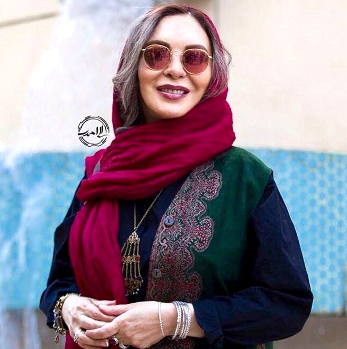 افسانه بایگان با صورت پف کرده تزریقی همه را وحشت زده کرد| آقای جوان کنار افسانه بایگان کیست؟