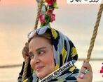  فرم چشم بهاره رهنما بعد عمل بهم ریخت!