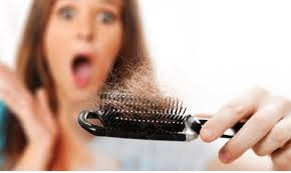 با این روش خانگی از شر ریزش مو خلاص شوید/ یک راه حل ساده برای رفع ریزش مو