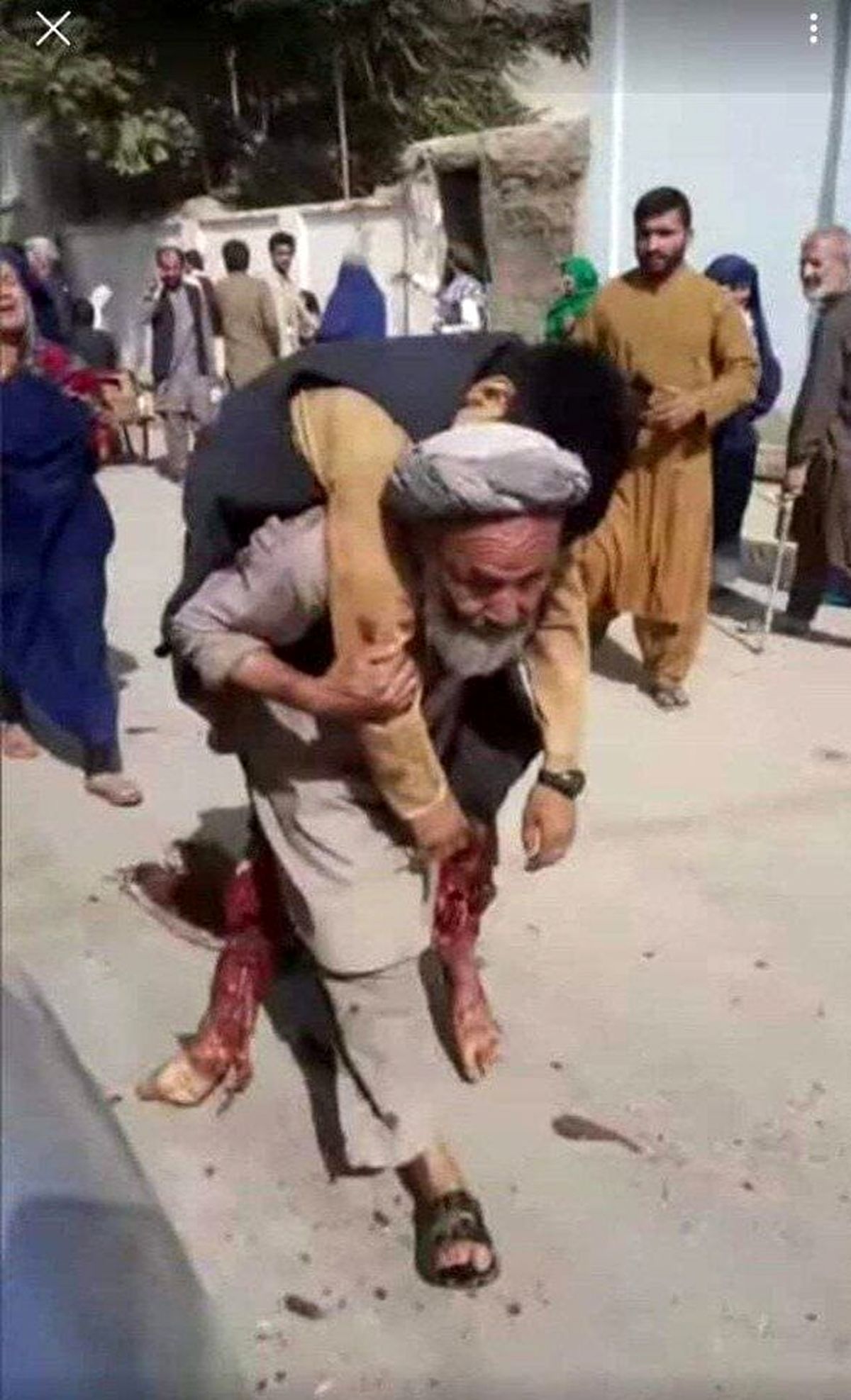 عکس تکان دهنده از به دوش کشیدن جنازه پسر توسط پدر!