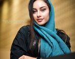 کتک کاری ناباورانه ترلان پروانه| صورت له شده ترلان پروانه همه را ترساند! 