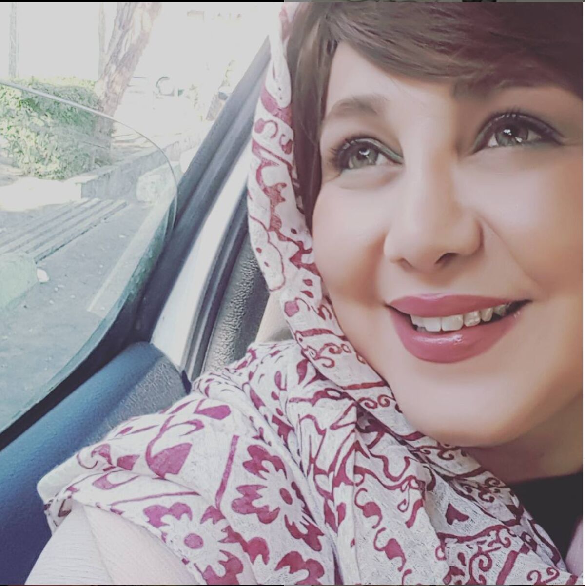 عکس باور نکردنی از چهره قبل عمل بهنوش بختیاری