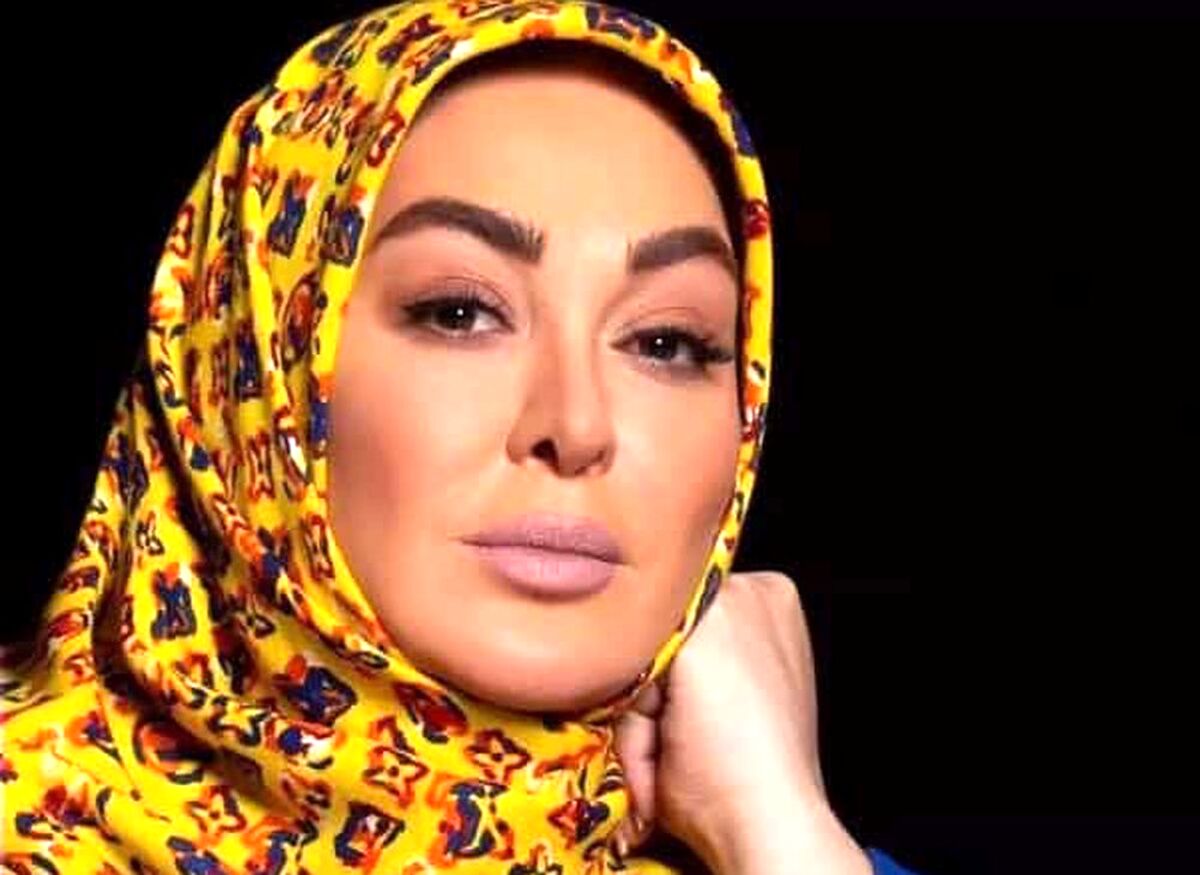 تغییر چهره عجیب الهام حمیدی قبل و بعد از عمل جراحی + عکس های الهام حمیدی 