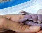 تولد یک نوزاد عجیب‌الخلقه در عراق + تصاویر