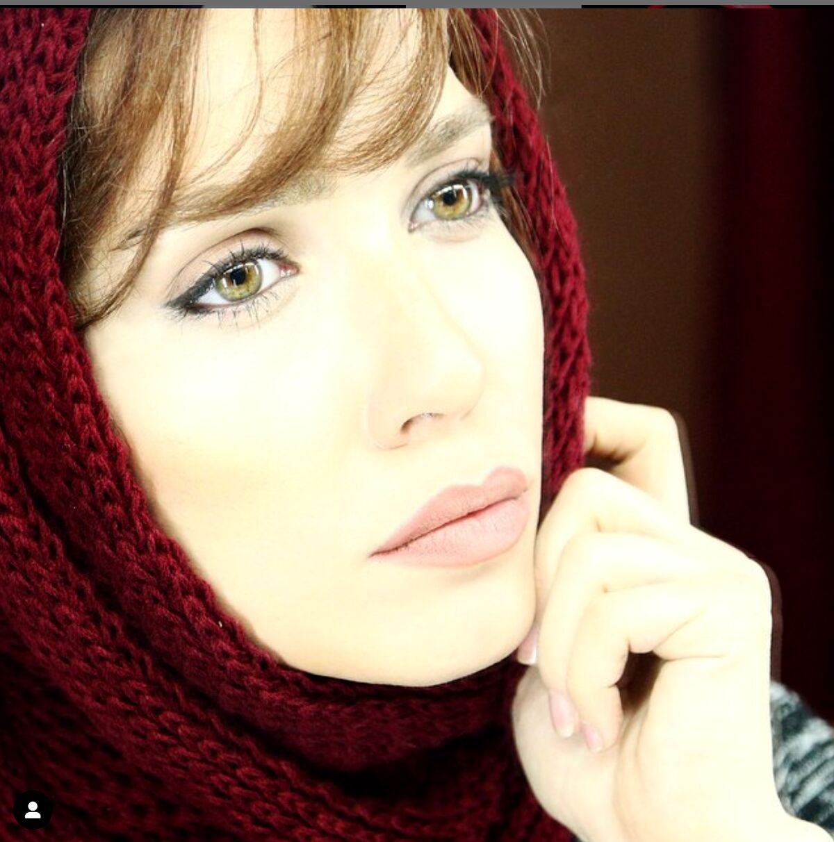شهرزاد کمال زاده در بیمارستان