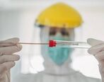 بهترین زمان برای انجام تست pcr چه موقع است ؟ + جزئیات 