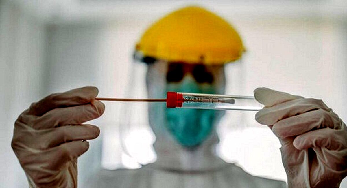 بهترین زمان برای انجام تست pcr چه موقع است ؟ + جزئیات 