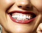چگونه از لثه‌هایمان به درستی مراقبت کنیم؟