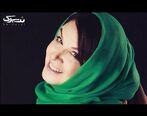 چهره داغون شهره سلطانی با بینی خیلی کج!+ عکس