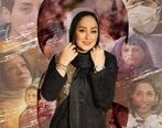 عکس جدید الهام حمیدی از صورت بی حالش