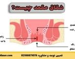 زخم مقعد در اثر یبوست نشانه چیست و چگونه درمان میشود؟