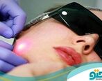 ویژگی های مهم دکتر اندولیفت که باید بدانید !

