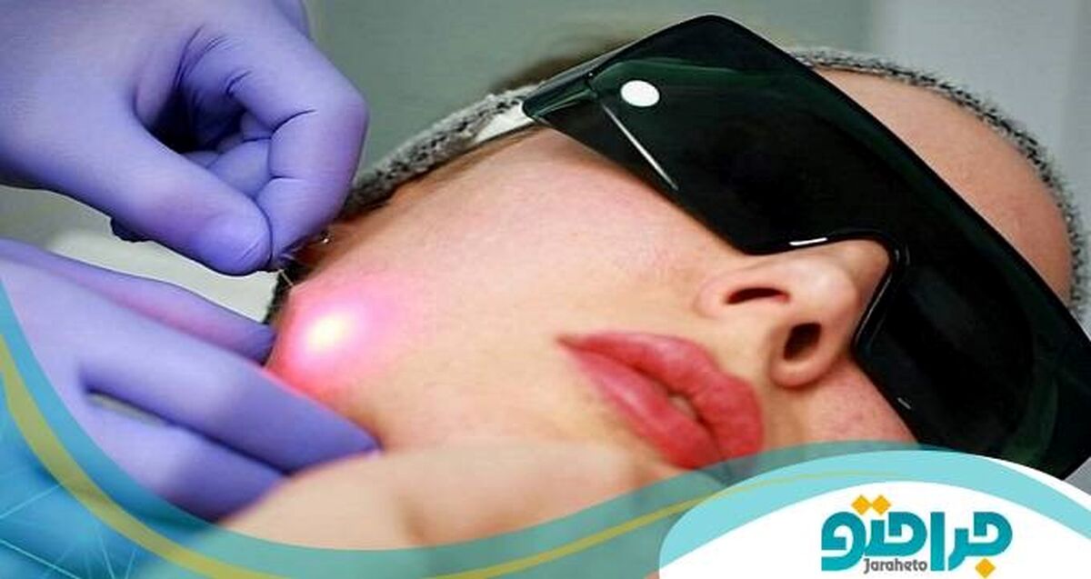 ویژگی های مهم دکتر اندولیفت که باید بدانید !

